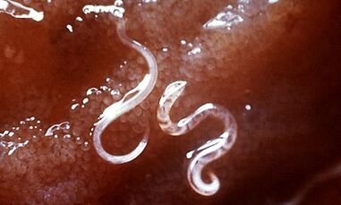 Was Parasiten in der Leber beim Menschen sind